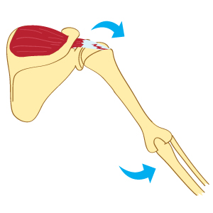 Differential Diagnosis
